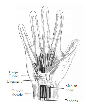 Course Content - #91952: Carpal Tunnel Syndrome - NetCE