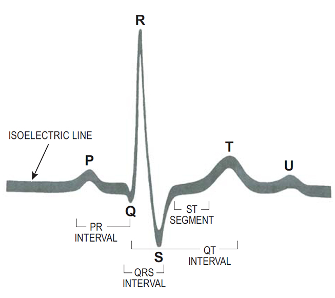 Course Content - #90823: Clinical Management Of Atrial Fibrillation - Netce