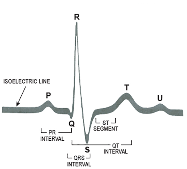 Course Content - #90373: Clinical Management of Ventricular Arrhythmias ...